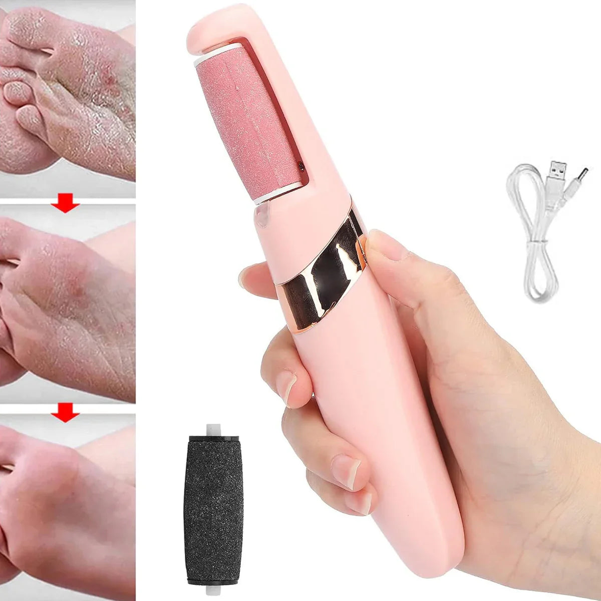 Smooth Step Pro Electric Pedicure Care Kit