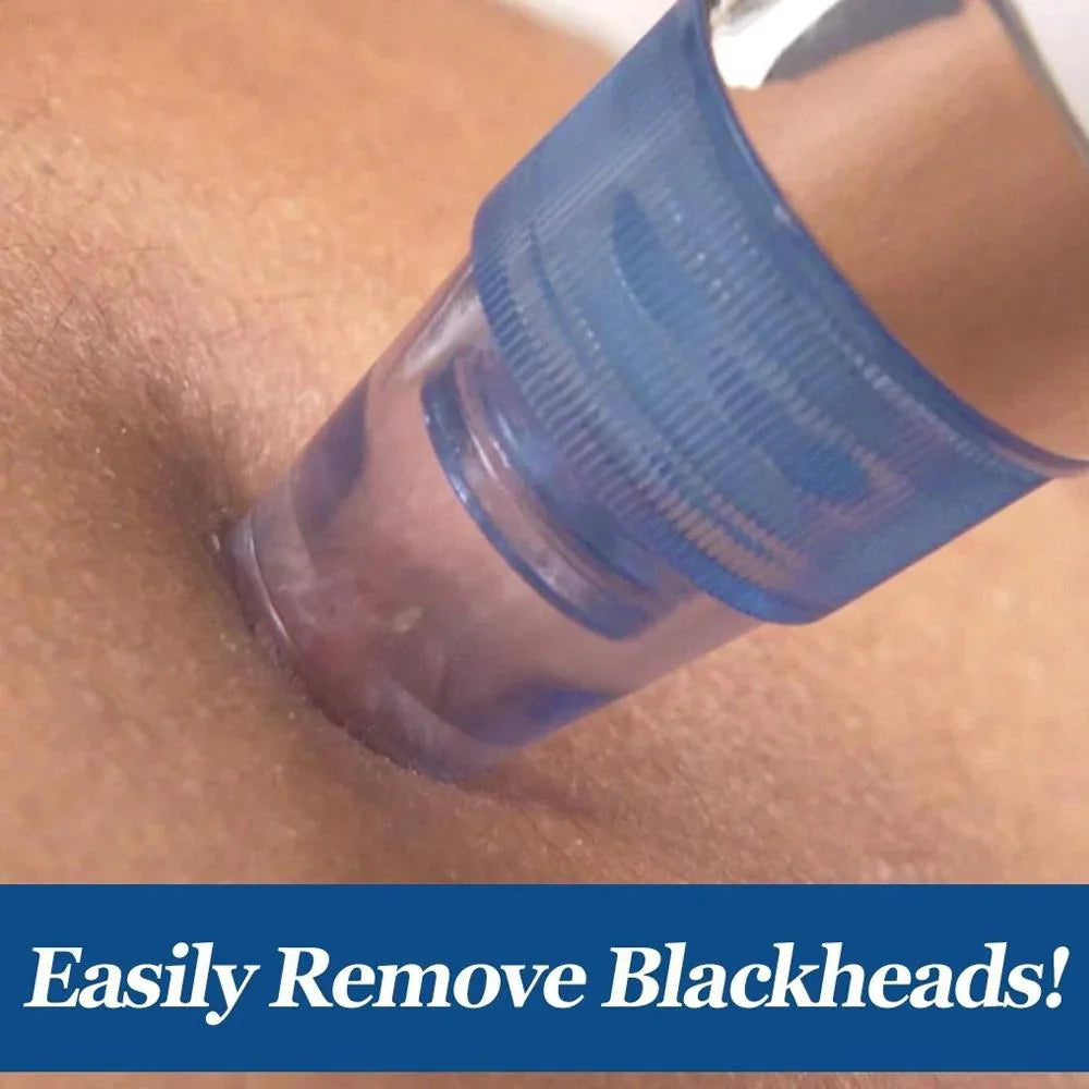 Clear Skin Pro 4-in-1 Pore Vacuum & Blackhead Remover